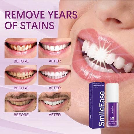 Hismile v34 Colour Corrector Serum Purple Teeth Whitening & Stain Removal